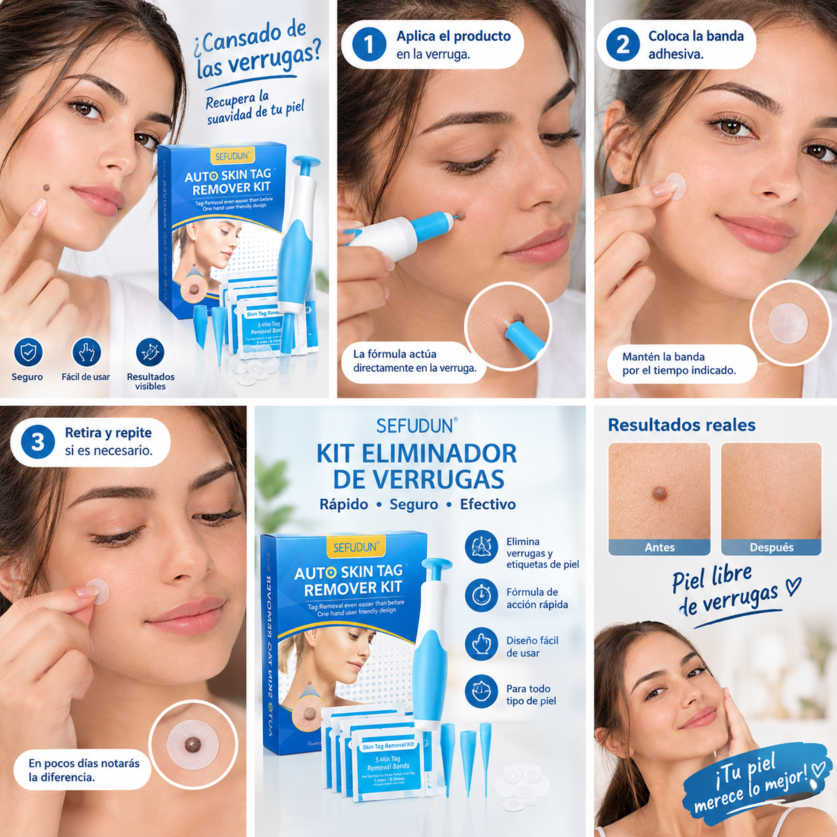 Kit Eliminador de Verrugas